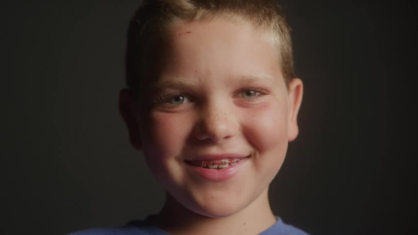 A young boy laughs in a room revealing his braces
