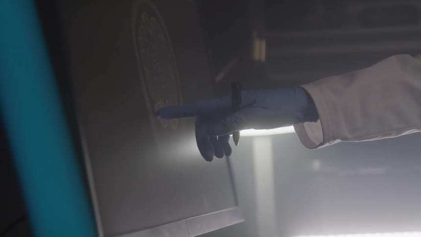 Hand with a glove holding a pen and pointing to a brain on a computer screen
