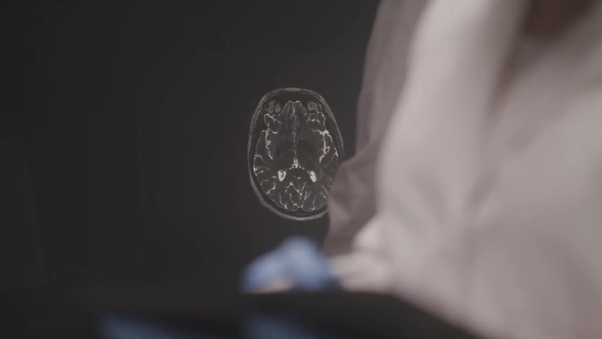 Monitor displaying a brain scanner and in the foreground a person with a glove holding a pen