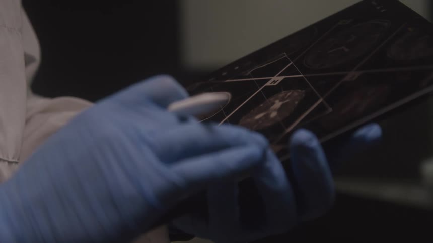Person in blue gloves examines xray film in dim light