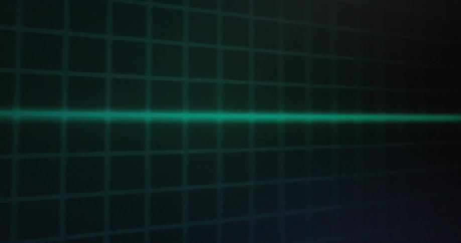 Flatline on an electrocardiogram monitor