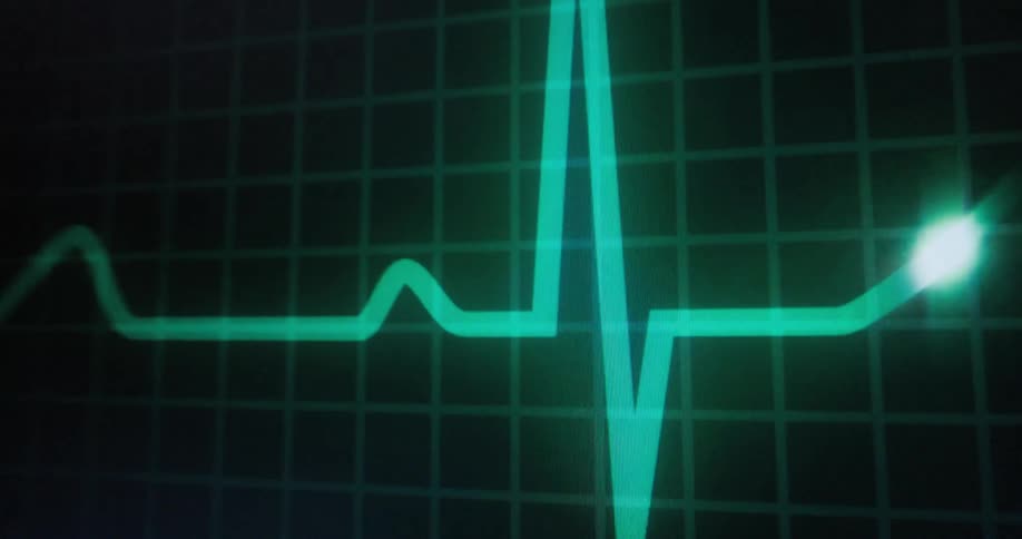 An electrocardiogram ecg or ekg reading during a medical test used to assess heart health