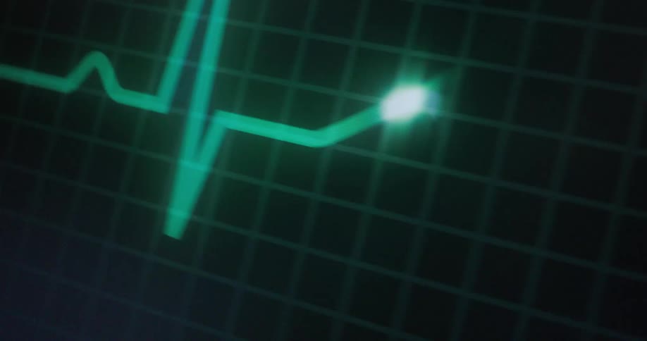 A glowing green line spikes sharply on a digital heart monitor screen signaling a sudden change in rhythm