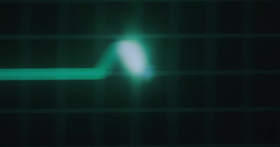 A heart monitors glowing green ecg line traces the rhythm of a heartbeat across a dark gridded screen