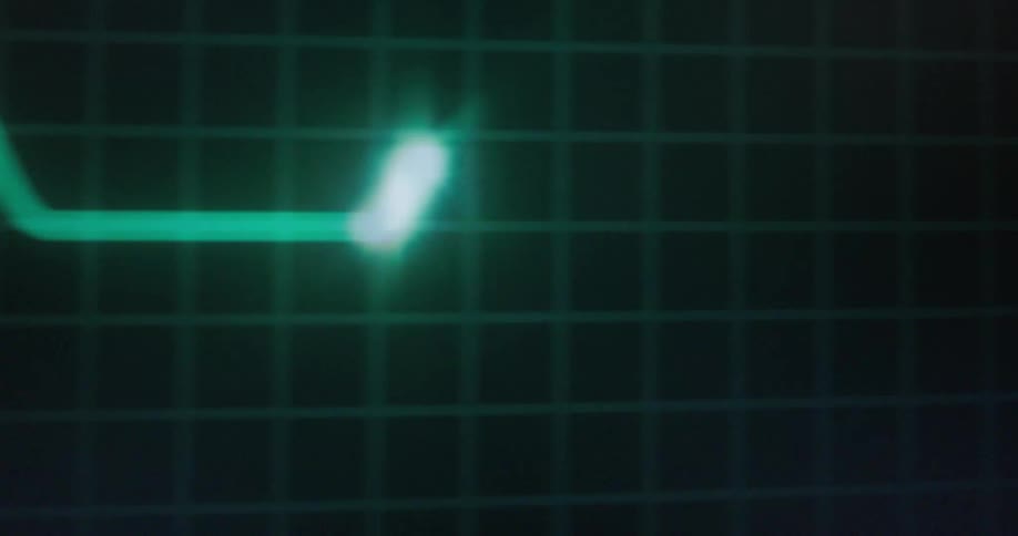 An electrocardiogram ecg or ekg reading during a medical test used to assess heart health