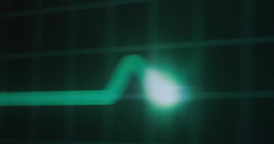 A green waveform with a bright pulsing light moves across a dark screen with a grid pattern