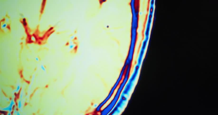 The imaging of a brain is on display