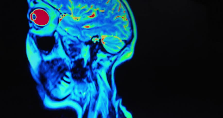 A persons face is shown in a colorful thermal scan or mri with different colors indicating activity the scan shifts and moves to a side view of the head revealing the brain and spinal column in shades of blue red and yellow