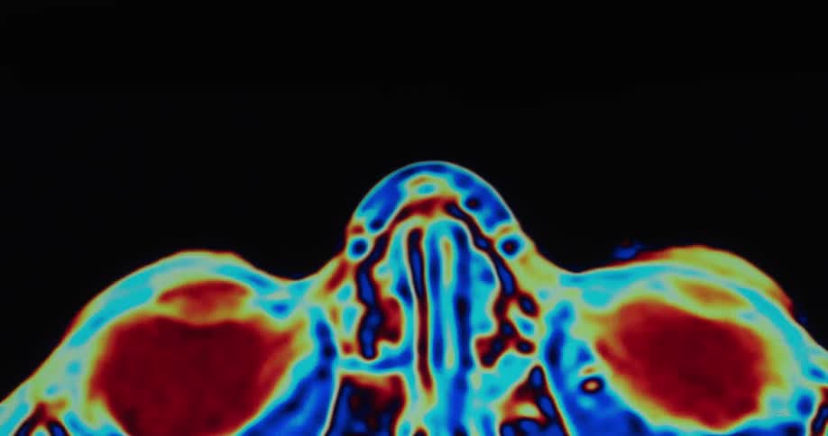 A colorful medical scan of a human head and brain on a black background showing different cross sections with arteries and veins in red and blue