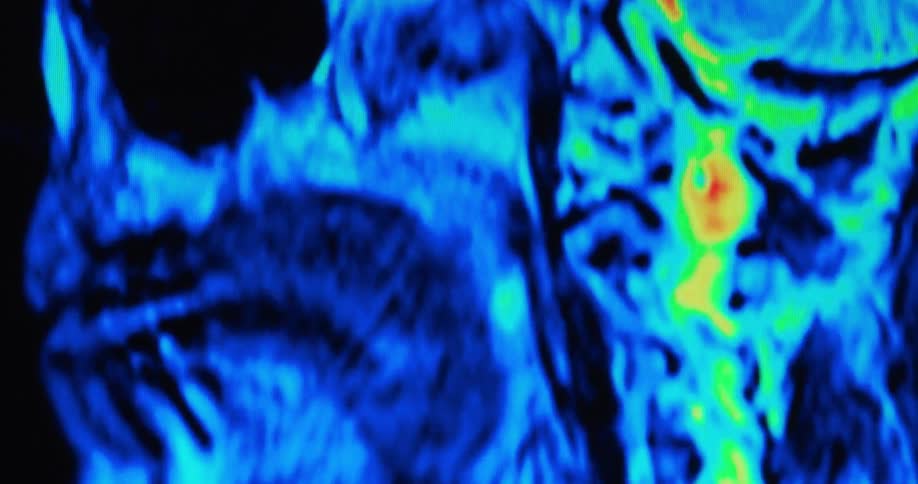 Functional magnetic resonance imaging in color