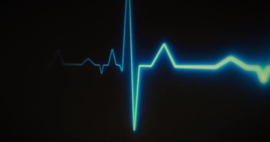 A bright glowing bluegreen line on a medical monitor traces a clear rhythmic electrocardiogram ecg waveform against a dark gridded background