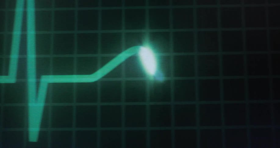 A green waveform with a bright pulsing light moves across a dark screen with a grid pattern