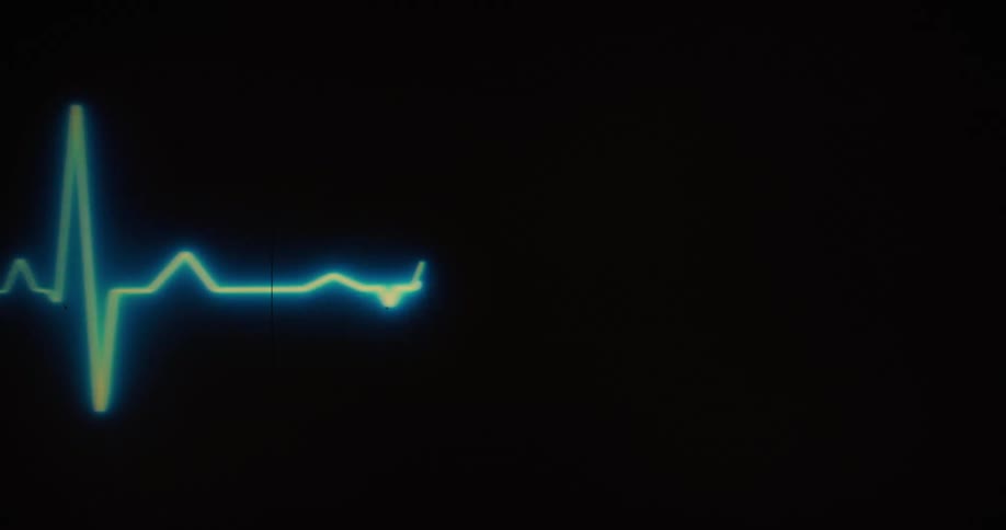 A waveform with a bright pulsing light moves across a dark screen with a grid pattern