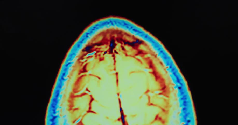 Colorful animated medical scan imagery contrasts with a black background