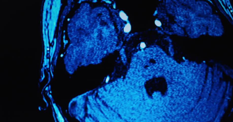 Overhead ct scan shows different levels of a human head