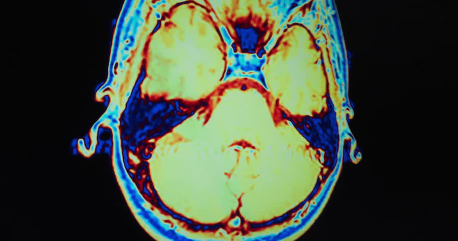 Colorful medical scan image changes against a black background