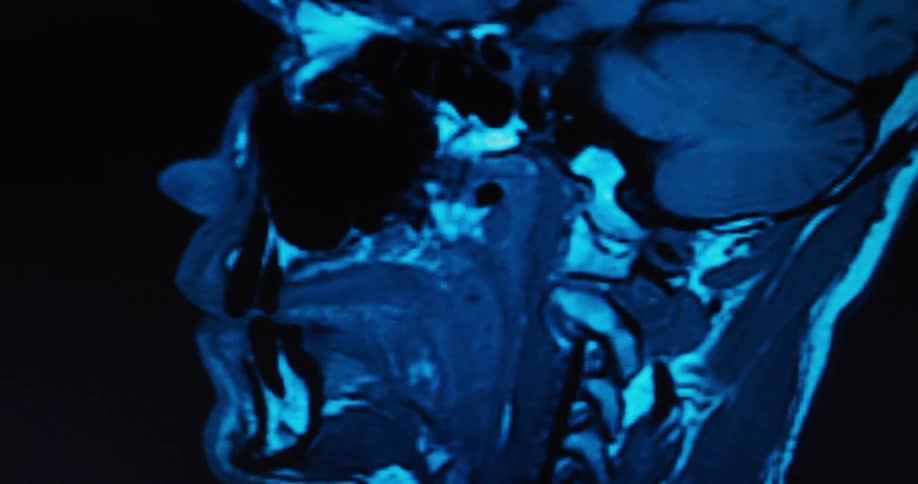 The scan of the persons face moves