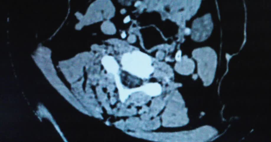 A medical scan of a human neck and head slowly scrolls down showing different cross sections of bones and soft tissue on a dark screen