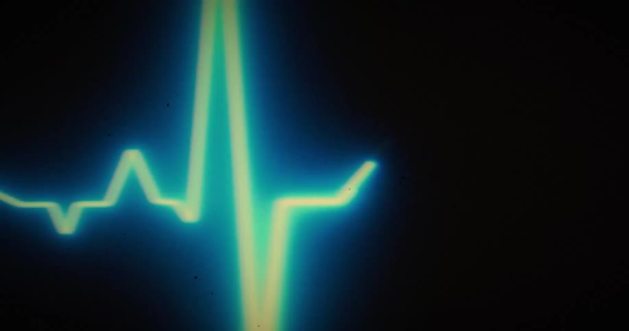 A glowing blue and green line representing an electrocardiogram ecg waveform pulses across a black heart monitor screen