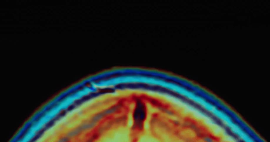 A colorful medical scan of a human head and brain rotates on a black background showing different cross sections with arteries and veins in red and blue