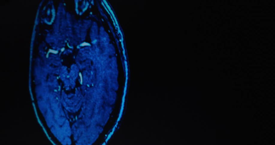 The medical imaging is moving around fast