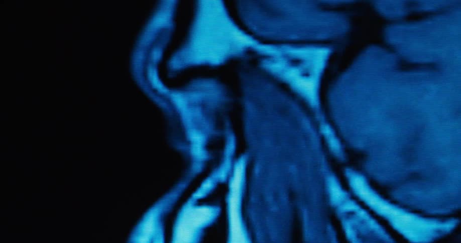 Blue and black fluids morphing in and out of each other to form circular shapes