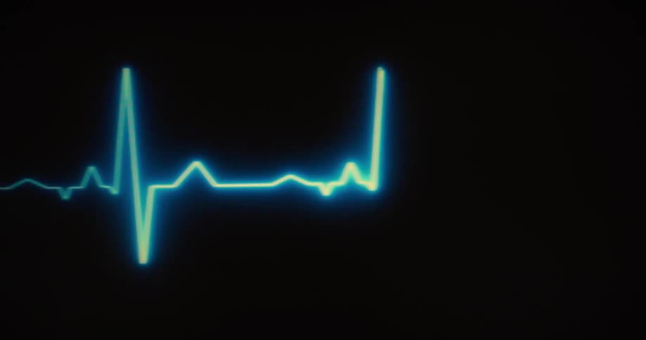 A bright blue glowing waveform of a heart monitor is in the center of a black screen