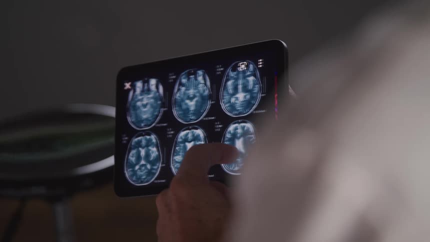 The video shows a persons hands holding a tablet which displays multiple brain scans the person is using their fingers to navigate and zoom on the different images of the brain