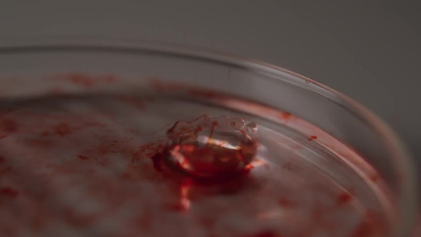 Drops of blood fall in the petri dish