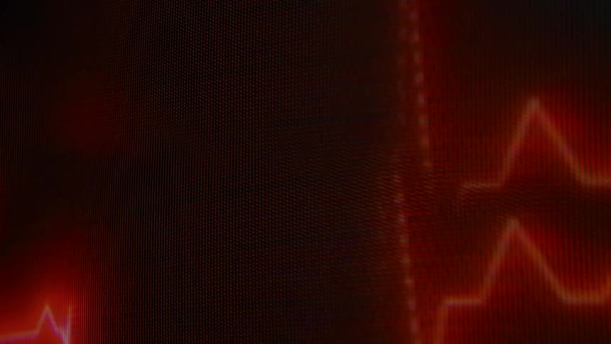 The video shows two horizontal lines one on top of the other that move horizontally across a dark background the top line is straight while the bottom line has a wavelike or jagged pattern similar to a heartbeat monitor display