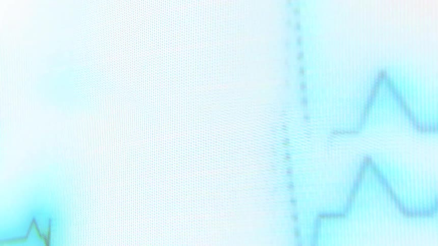 A blue digital ecg heart rate line pulses on a pixelated screen