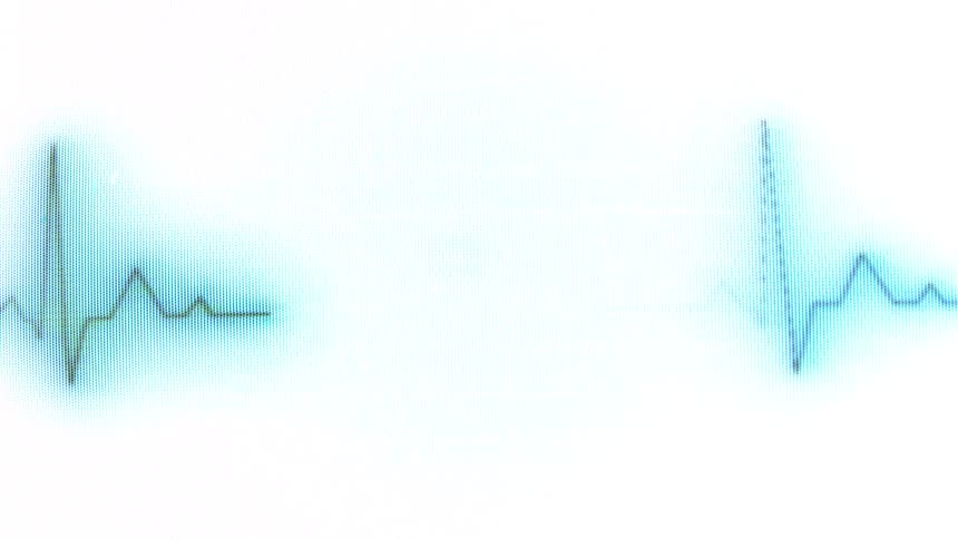A glowing blue electrocardiogram waveform displayed on a white background