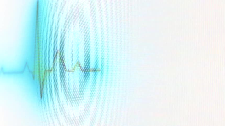 A video shows a closeup shot of an ekg or cardiogram the line on the screen is moving indicating a persons heartbeat