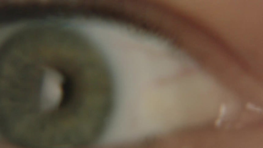 A person blinks revealing a green eyelid