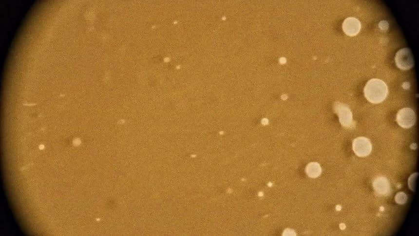 A bacterial culture under a microscope
