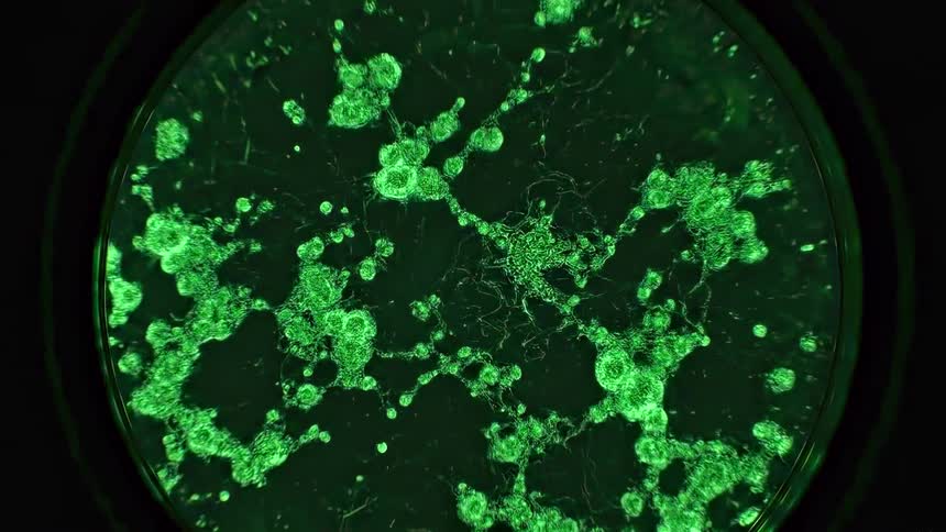 The video shows a timelapse of glowing green bacterial colonies rapidly growing and spreading across a petri dish the tiny separate dots multiply and connect to form a complex interconnected network of biological structures
