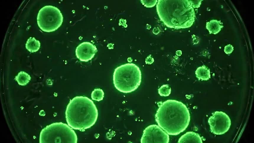 Microorganisms growing in a petri dish glow green against a dark background