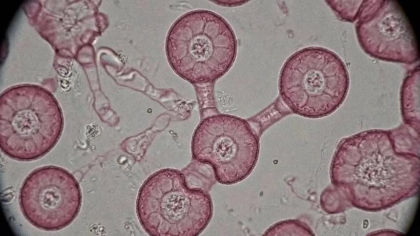 Cells or spores grow and connect under a microscope