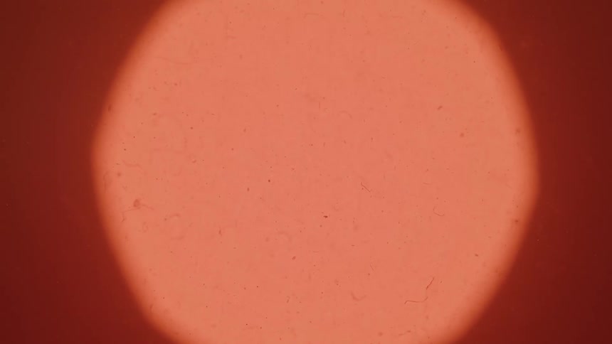 Microscopic organisms in extreme closeup