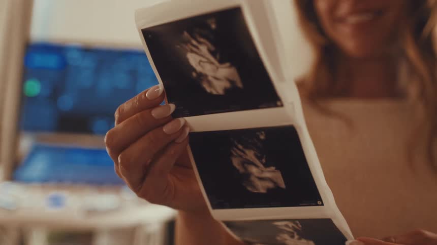 A young woman inside a hospital holds a strip of ultrasound images likely from a prenatal scan with a huge smile on her face