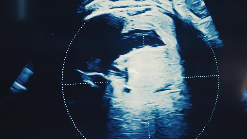The video shows an ultrasound of an unborn baby the first line of the video shows the fetus in profile on a dark blue and white screen with a dotted circular outline appearing around the fetuss torso and head the second line focuses on the fetuss hea