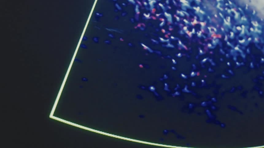 An ultrasound scan image displayed on an ultrasound machine likely from a prenatal scan