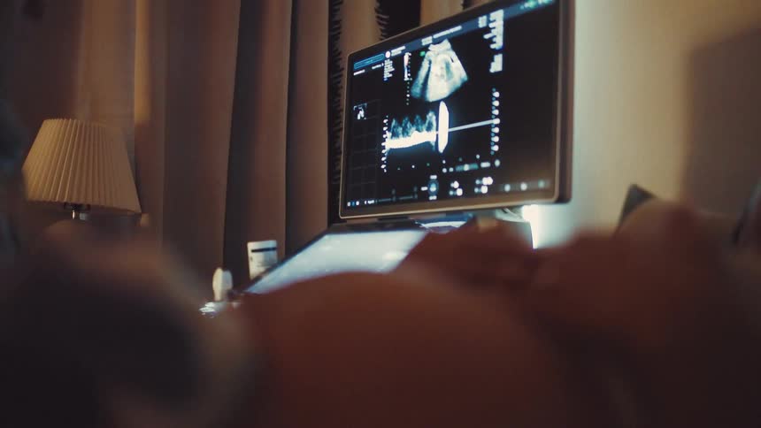 Ultrasound exam displays the babys image on the monitor screen