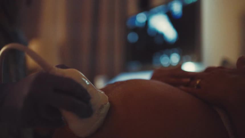 Healthcare technician performing an ultrasound scan on a pregnant woman