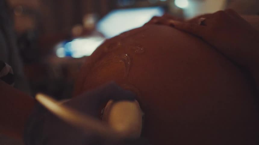 A pregnant female lies on an examination bed as a medical professional performs an ultrasound with monitors and equipment glowing in the dimly lit room