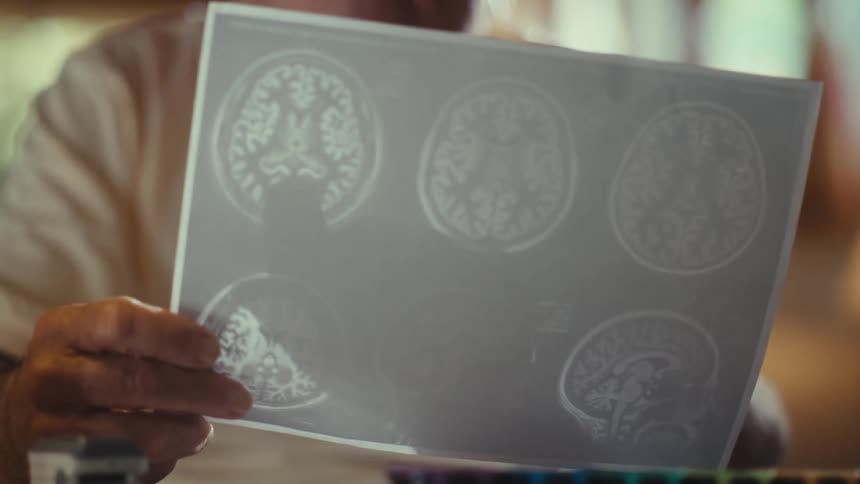 The man is pointing to images on a ct scan