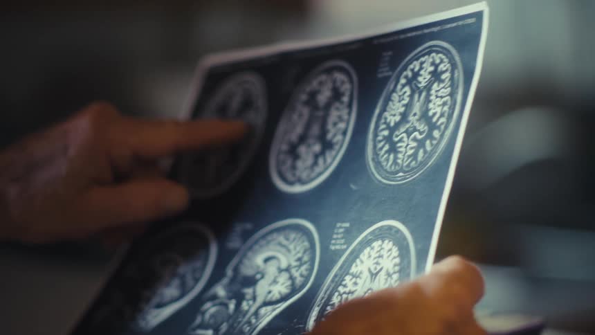 An orderly person is looking desperately to a ct scan report