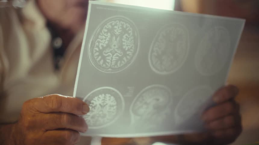Elderly man holding a brain mri scan