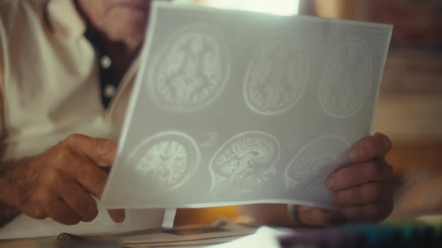 The man points to images on the print out of a ct scan