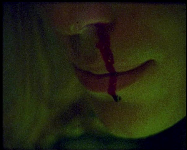 The womans nose is bleeding